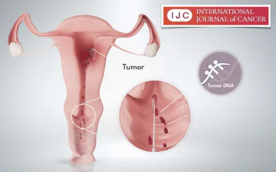The performance of the WID-qEC test in black women