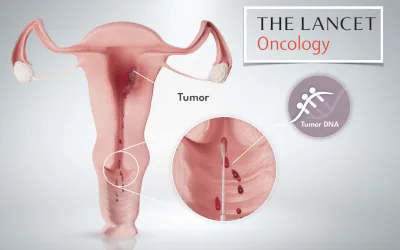 90 % less surgical diagnostic procedures with the WID®-easy Test