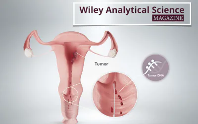 High-throughput analytics for the WID®-easy Test
